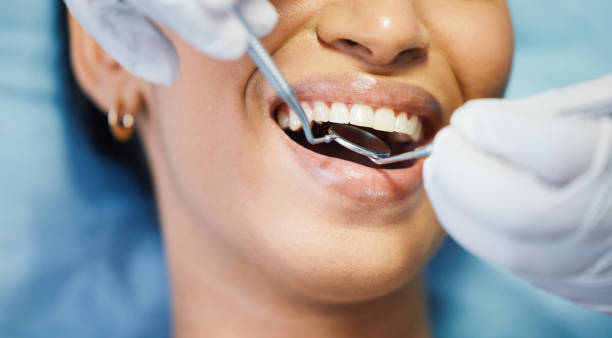 Best Emergency Broken Tooth Repair in Huntingdon, TN