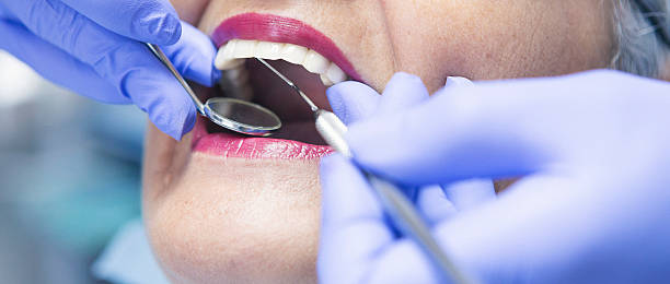 Best Emergency Broken Tooth Repair in Huntingdon, TN